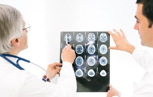 Closing In on Alzheimer's Disease