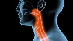 Cancer on the rise(doctoroz)