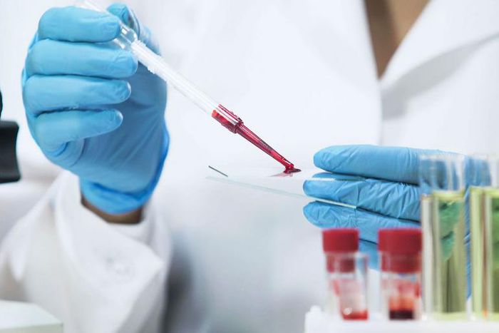 Second HIV Patient Has Been "Cured" of the Diseae