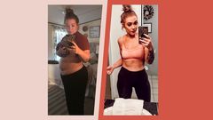 'I Lost 125 Pounds After Gastric Bypass Surgery'