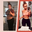 'I Lost 125 Pounds After Gastric Bypass Surgery'