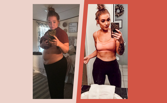 'I Lost 125 Pounds After Gastric Bypass Surgery'
