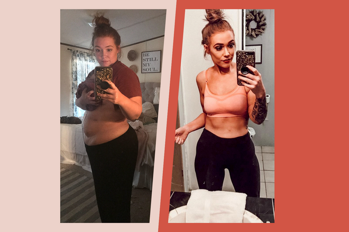 'I Lost 125 Pounds After Gastric Bypass Surgery'