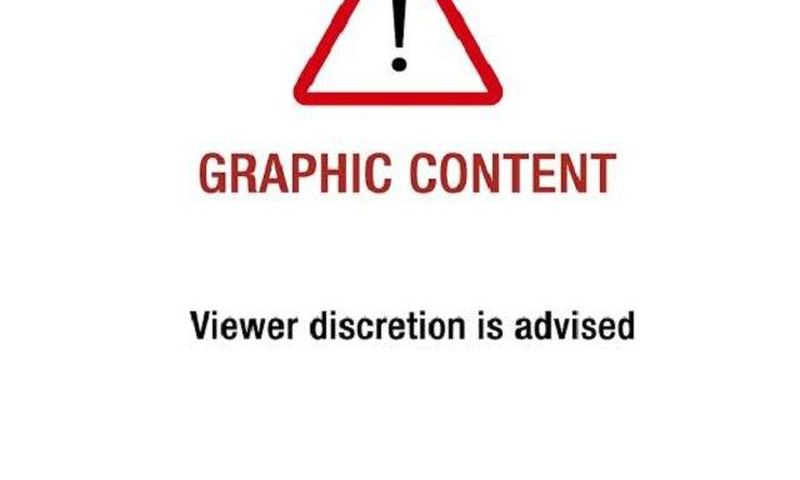 You are about to view picture(s) that may be disturbing.