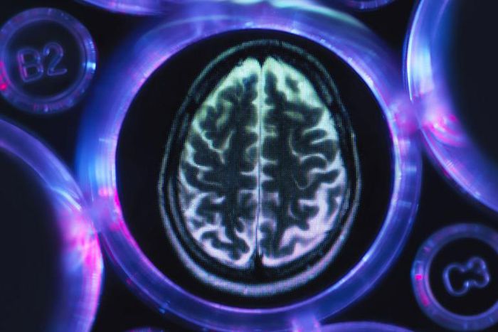 Men's Brains are Older than Women's