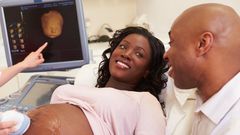 Ectopic pregnancy(kofinasperinatal)