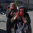 Wounded Afghan women at the site of a car bomb attack in Kabul that killed scores of people on May 31, 2017