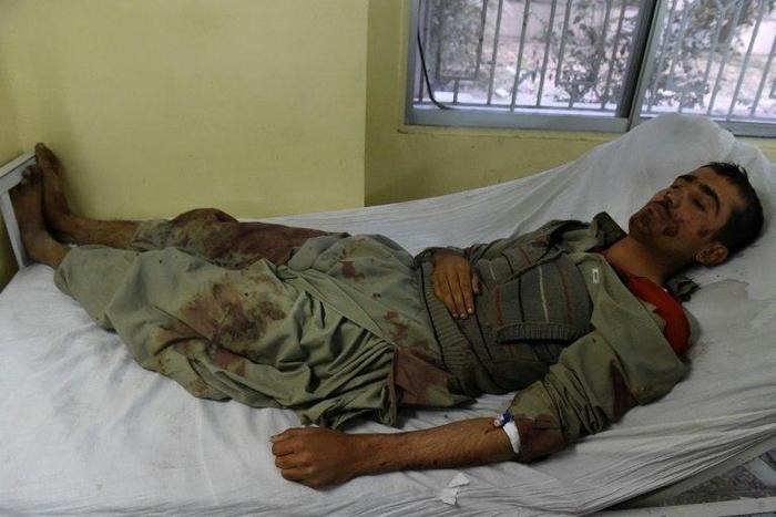 An injured policeman lies on a bed at a hospital in Quetta on October 25, 2016 after a militant attack targeting a Pakistani police academy