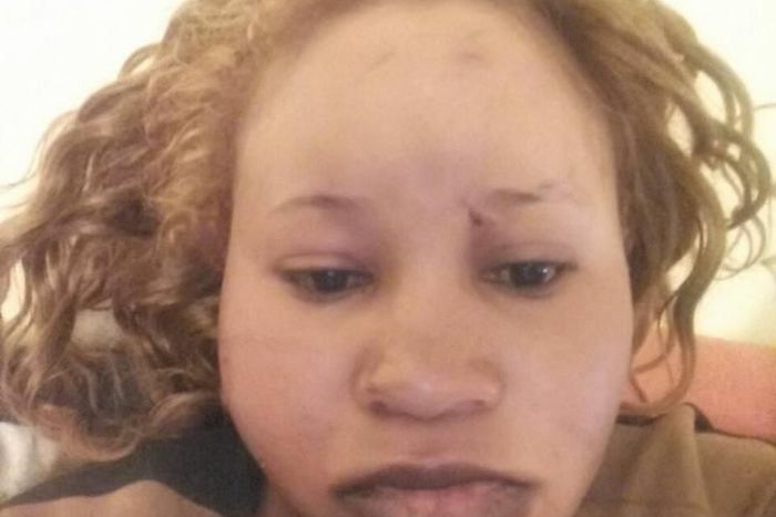 Nyasuguta after her attack