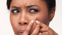 Steaming face can help get rid of skin breakouts (Courtesy)
