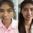 A photo combo by Paveena Foundation in 2016 and AFP's Lillian Suwanrumpha in 2017 of Thai schoolgirl Naruedee Jotsanthia who was left facially disfigured after a schoolteacher who threw a mug at her head