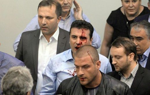 Opposition Social Democrats leader Zoran Zaev bleeds after being injured when supporters of former leading party VMRO-DPMNE entered the parliament following an allegedly unfair vote for a parliamentary speaker in Skopje on April 27, 2017