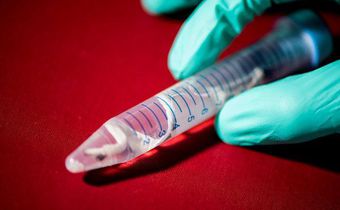 What's pink and pinstriped and digests wood? This new shipworm