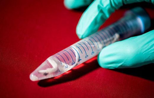 What's pink and pinstriped and digests wood? This new shipworm