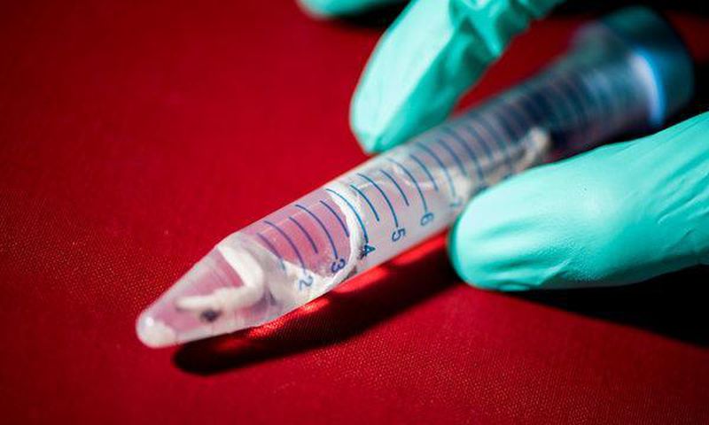 What's pink and pinstriped and digests wood? This new shipworm