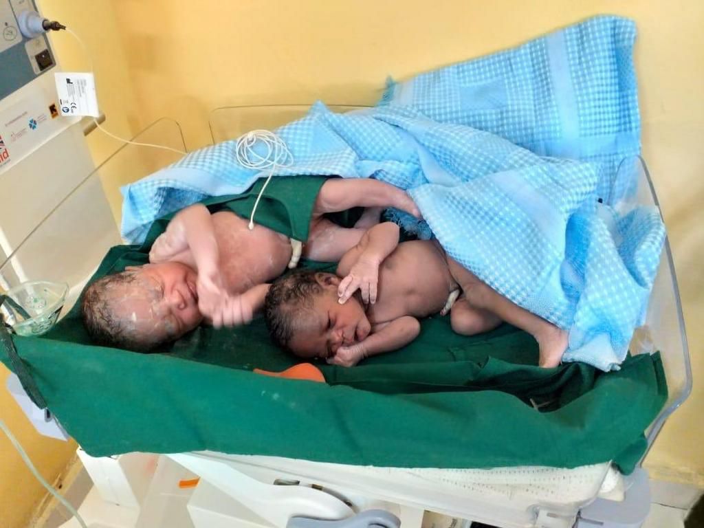 Twins delivered at Lorugum Sub County Hospital, Loima in the first successful c-section performed in the area (Twitter)