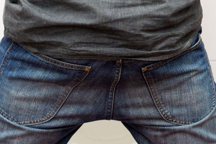 Frequent urination in men causes (Buoy health)