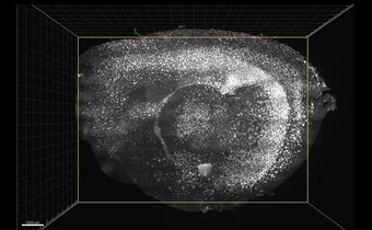 Flashing Lights and Sounds Improve Memory and Learning Skills in Mice