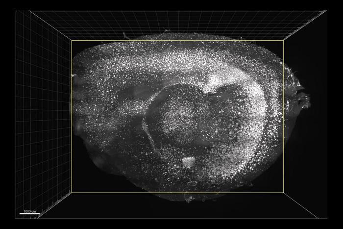 Flashing Lights and Sounds Improve Memory and Learning Skills in Mice