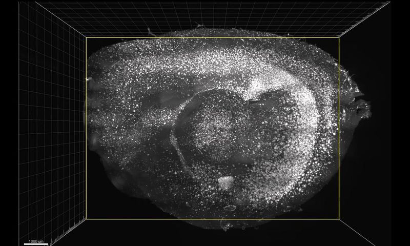Flashing Lights and Sounds Improve Memory and Learning Skills in Mice