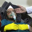 A Syrian man receives treatment at a small hospital in the town of Maaret al-Noman following a suspected toxic gas attack in Khan Sheikhun on April 4, 2017