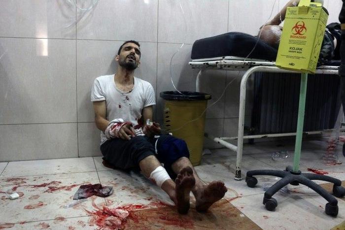 A wounded man sits on the floor in a crowded makeshift hospital in eastern Aleppo as regime aircraft and artillery pounded neighbourhoods in the rebel-held sector of Syria's second city on November 18, 2016