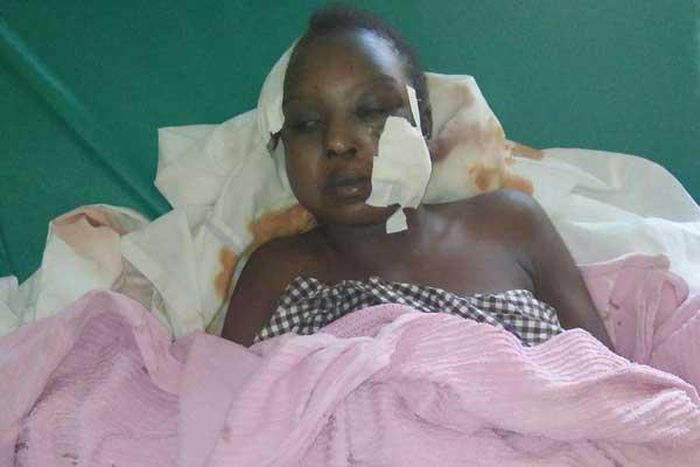 ___6676804___https:______static.pulse.com.gh___webservice___escenic___binary___6676804___2017___5___15___8___woman+attakced