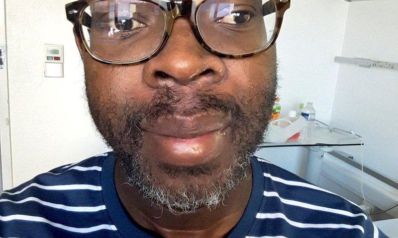 Photo shared by Kibra MP Ken Okoth after follower asked about his condition (Twitter)
