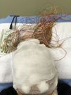 I was getting an EEG done in the midst of figuring out my diagnosis. They were tracking my brain function for epileptic brain waves over the time span of three hours here.