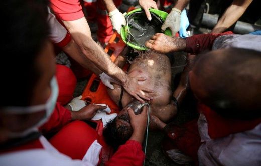 Rescue workers try to resuscitate a coal miner after he was pulled out from a mine in Azadshahr, northern Iran, following an explosion which left dozens of miners trapped on May 3, 2017