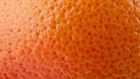 The Best Cellulite Treatments
