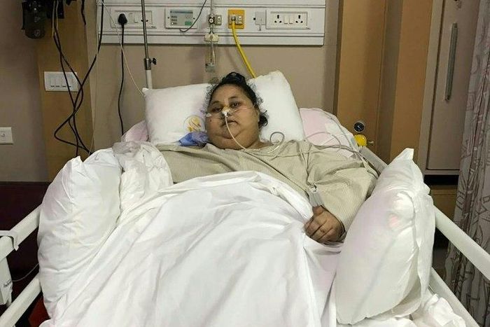 Egyptian patient Eman Ahmed Abd El Aty lies in a hospital bed at The Saifee Hospital in Mumbai on March 8, 2017, after her bariatric surgery