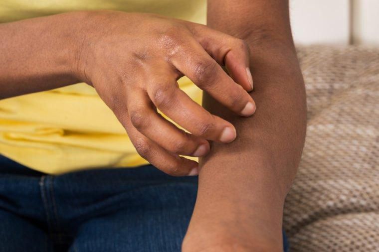 Itchy skin(Reader's Digest)