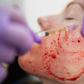Vampire Facials Might Be Causing HIV