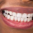 Remedies for bleeding gums(Reader's Digest)