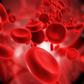 Iron deficiency(sciencedaily)