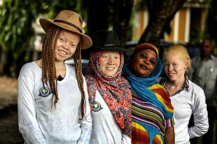 Tanzania's human rights campaigners say the number of attacks against albinos is in sharp decline, but their graves are increasingly being desecrated instead and their remains exhumed