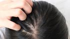 14 Best Shampoos For Thinning Hair