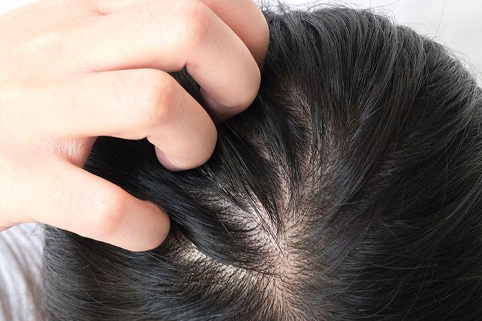 14 Best Shampoos For Thinning Hair