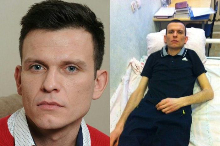 Picture combo created February 13, 2017 and provided by the family of lawyer Andrei Krekov shows him (left) on December 14, 2014 and (right) lying in a bed at a hospital in northwest Russia's Arkhangelsk region on February 13, 2016