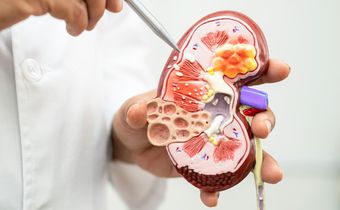 Health risks of living with a single kidney