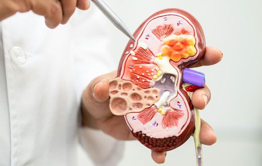 Health risks of living with a single kidney