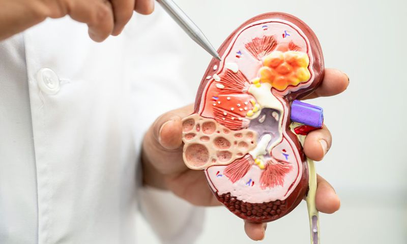 Health risks of living with a single kidney