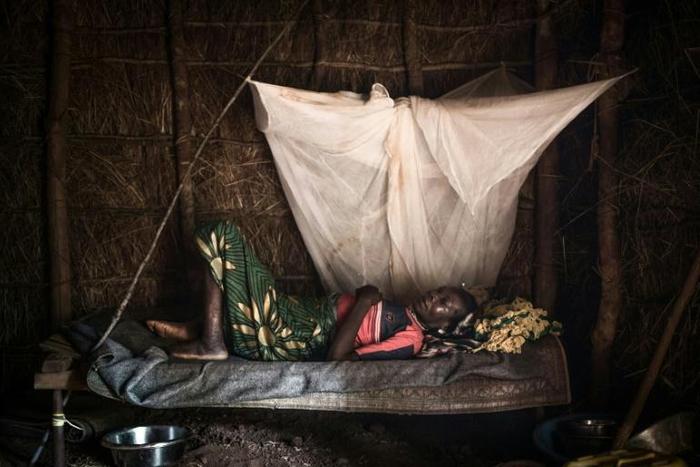 A patient awaits surgery in the hospital of the Zapai camp for displaced people in northern DR Congo