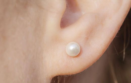 Dr. Pimple Popper Removed Blackhead On Earlobe