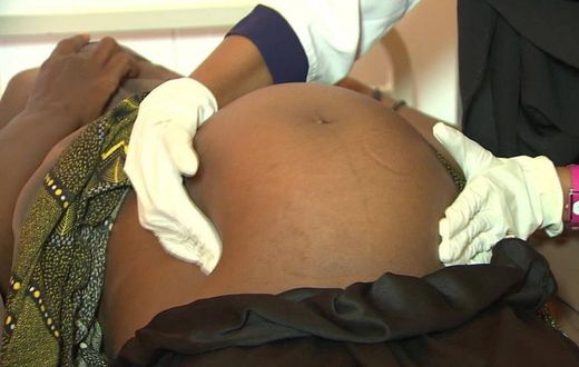 Dangers of being oveweight during pregnancy