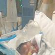 Baby Born Without Skin Is Slowly Recovering