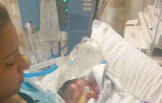 Baby Born Without Skin Is Slowly Recovering