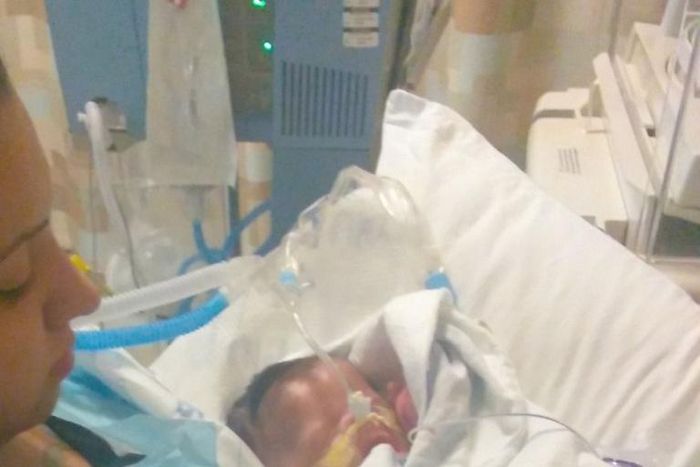 Baby Born Without Skin Is Slowly Recovering