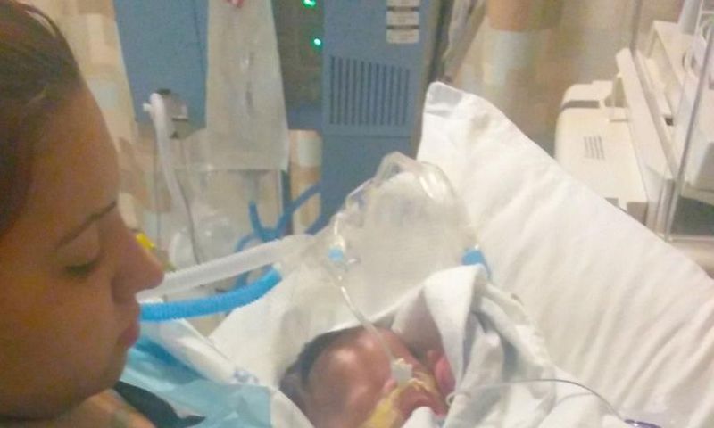 Baby Born Without Skin Is Slowly Recovering